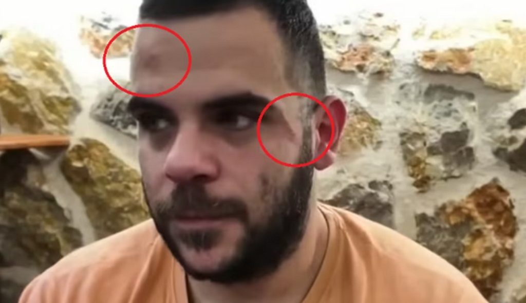 Ξυλοδαρμός και επίθεση με αυγά εις βάρος γνωστού Youtuber στα Ιωάννινα (βίντεο)