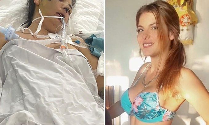 Βιετνάμ: 31χρονη από την Αυστραλία δίνει «μάχη» για τη ζωή της μετά από «ακίνδυνη» επέμβαση αισθητικής (φωτο)