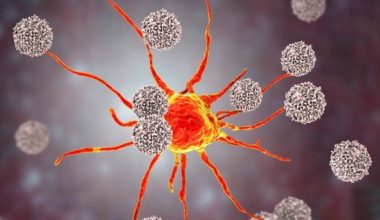 Όσα πρέπει να ξέρετε για τα αυξημένα λεμφοκύτταρα – Ποιες οι αιτίες