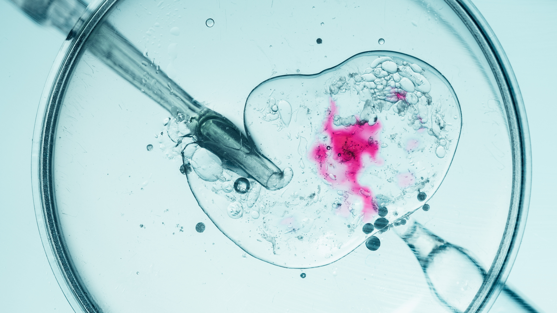 Οδηγίες από την Εθνική Αρχή Υποβοηθούμενης Αναπαραγωγής στους Έλληνες γονείς για το γενετικό υλικό του Δανού δότη