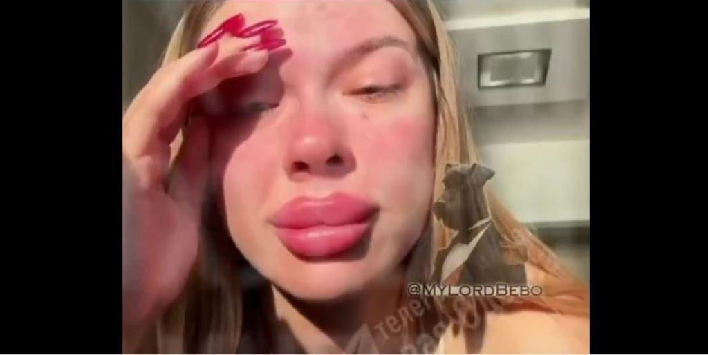 Ουκρανή του OF παραπονιέται που δεν υπάρχουν αρκετοί άνδρες στην Οδησσό για να γυρίσουν… ερωτικά πλάνα (βίντεο)