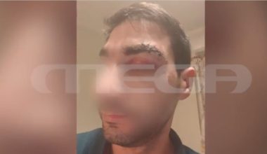 Σοκάρουν οι δηλώσεις του γιατρού από το Αίγιο: «Ο μποξέρ με πλάκωσε στο ξύλο – Δεν του άρεσε η μούρη μου» (βίντεο)