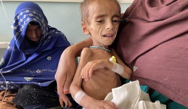 Ημέρες κόλασης στο Αφγανιστάν εξαιτίας του λιμού: 3,7 εκατ. παιδιά αντιμετωπίζουν οξύ υποσιτισμό