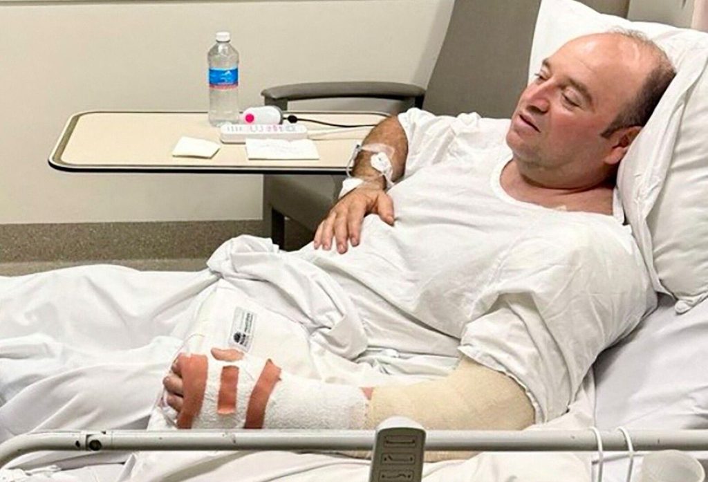 Σίδνεϊ: Κινδυνεύει να χάσει το χέρι του ο άνδρας που αφόπλισε τον δράστη του μακελειού – «Είναι γεμάτος σφαίρες»