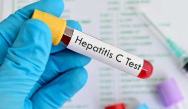 Νέο τεστ δείχνει μέσα σε περίπου 15 λεπτά αν κάποιος είναι θετικός στην Ηπατίτιδα C