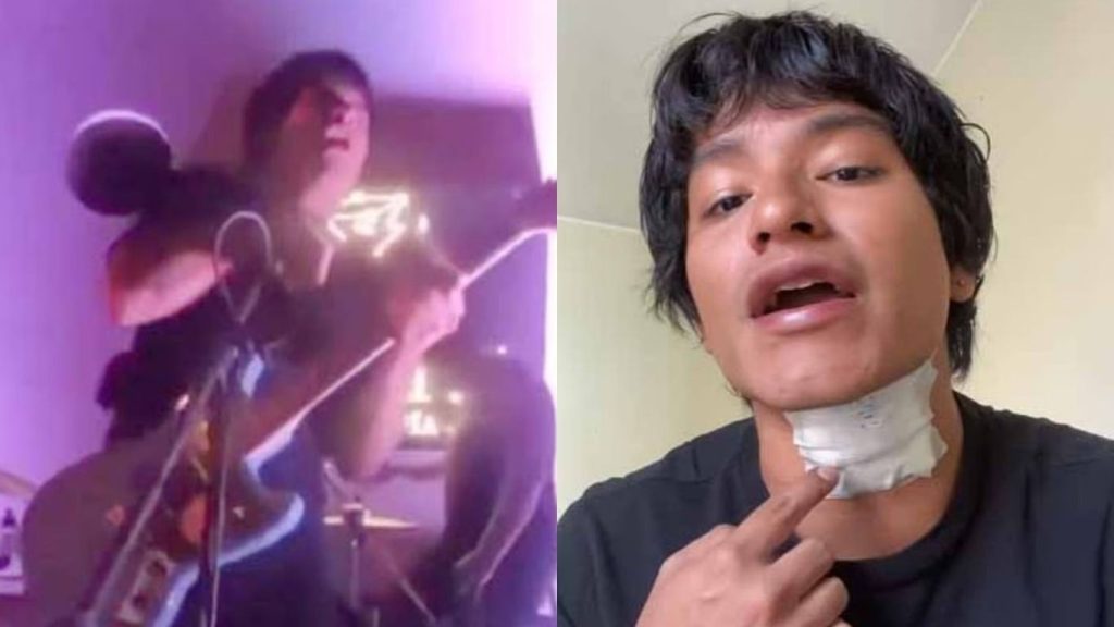 «Πανικός» σε μπαρ στο Περού: Η στιγμή που τραγουδιστής πιάνει το μικρόφωνο και παθαίνει ηλεκτροπληξία (βίντεο)