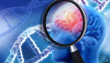 Νέα μελέτη: Όσοι ζουν σε χώρες της Βόρειας Ευρώπης διατρέχουν μεγαλύτερο κίνδυνο εμφάνισης Αλτσχάιμερ