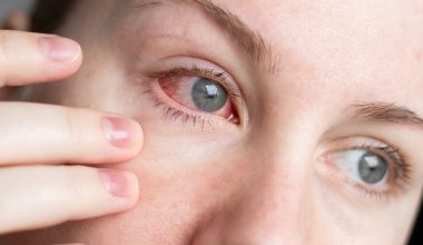 Όλοι οι πιθανοί λόγοι που το πρωί ξυπνάτε με κόκκινα μάτια