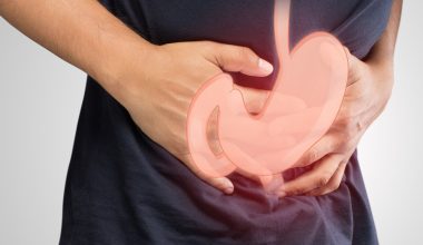 Γαστροπάρεση: Όταν το στομάχι αδειάζει πιο αργά από το φυσιολογικό – Ποια τα συμπτώματα