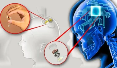 Σε μαζική παραγωγή μπαίνει το chip της Νeuralink