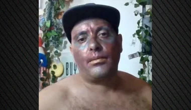 Ισπανία: 37χρονος «έσβησε» σε ζωντανή σύνδεση από υπερβολική κατανάλωση αλκοόλ και ναρκωτικών! (βίντεο)