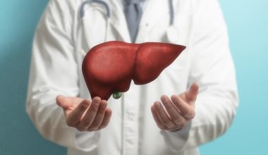 Λίπος στο συκώτι: Αυτοί είναι οι τέσσερις μύθοι – Ποια η αλήθεια