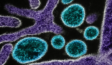 Εντοπίστηκαν δύο κρούσματα του ιού Nipah στη Δυτική Βεγγάλη – Ποια τα συμπτώματα