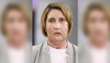 Στην Ισπανία η πρώτη μεταμόσχευση προσώπου από δότρια που υποβλήθηκε σε υποβοηθούμενη ευθανασία