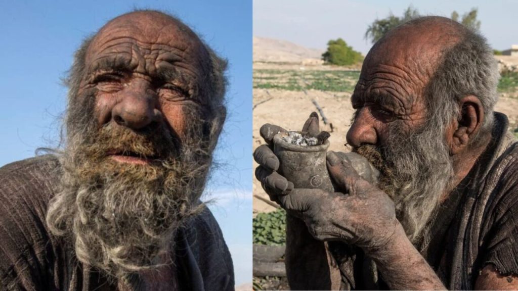 Είχε να πλυθεί 60 χρόνια: Πέθανε λίγους μήνες αφού τον είχαν πάει να κάνει μπάνιο