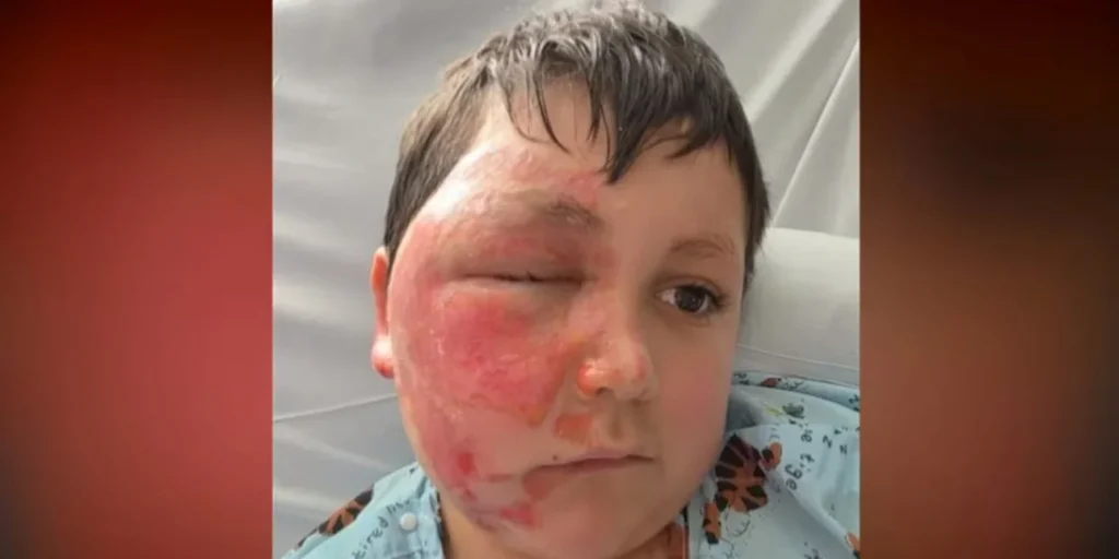 Το επικίνδυνο challenge του TikTok με φούρνο μικροκυμάτων: 9χρονος υπέστη σοβαρά εγκαύματα (βίντεο)