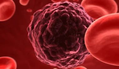 Νέα έρευνα: Kαινοτόμα προσέγγιση στην ανοσοθεραπεία βοηθά στην καταπολέμηση των αιματολογικών καρκίνων