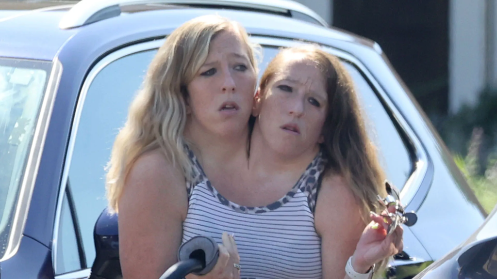 Abby και Brittany Hensel: Οι 35χρονες σιαμαίες εθεάθησαν να μεταφέρουν ένα νεογέννητο μωρό – Η απάντησή τους (φώτο)