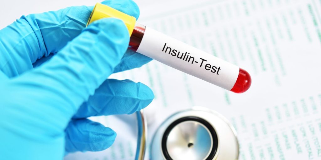 Δείτε ποιοι είναι οι 12 καρκίνοι που συνδέονται με την αντίσταση στην ινσουλίνη