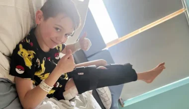 Ηνωμένο Βασίλειο: Το πρώτο παιδί που υποβλήθηκε σε επέμβαση επιμήκυνσης ποδιών – Κέρδισε τρία εκατοστά