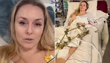 Λίντσεϊ Βον: «Έφτασα πολύ κοντά στον ακρωτηριασμό του ποδιού – Ο γιατρός με έσωσε κάνοντάς μου φασιοτομή» (βίντεο)