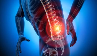 Πόνος στη μέση: Τα 5 συμπτώματα που δείχνουν ότι πρέπει να πάτε στον γιατρό