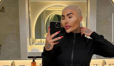 Τζόρνταν Τζέιμς Παρκ: Πέθανε ο 34χρονος που δαπάνησε 150.000 δολάρια για να μοιάσει στην Κιμ Καρντάσιαν (φώτο)