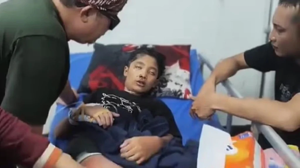 Ινδονησία: Μητριά ανάγκαζε 12χρονο να πίνει βραστό νερό – Το αγόρι την κατήγγειλε και ξεψύχησε (βίντεο)