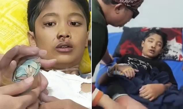 Μητριά στην Ινδονησία ανάγκασε 12χρονο να πιει βραστό νερό: Την «έδειξε» λίγο πριν ξεψυχήσει (βίντεο)