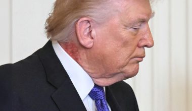 Τι συμβαίνει με την υγεία του Ν.Τραμπ; – Το εξάνθημα στον λαιμό του που προκαλεί εκ νέου ερωτήματα (βίντεο)