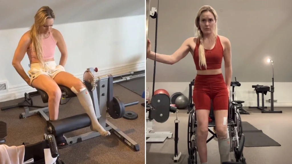 Λίντσεϊ Βον: Έτοιμη να περπατήσει ξανά – Ξεκίνησε ασκήσεις αποκατάστασης (βίντεο)