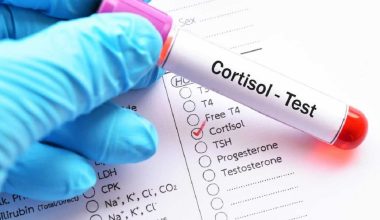 Κορτιζόλη: Αυτές είναι οι 11 πιθανές αιτίες που αυξάνουν την ορμόνη του στρες
