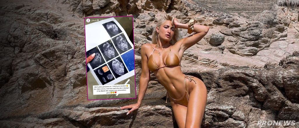 «Τα ύστερα του κόσμου»: Η Ιωάννα Τούνη «το τερμάτισε» – Ανέβασε βίντεο από το σπιράλ που έβαλε στον γυναικολόγο!