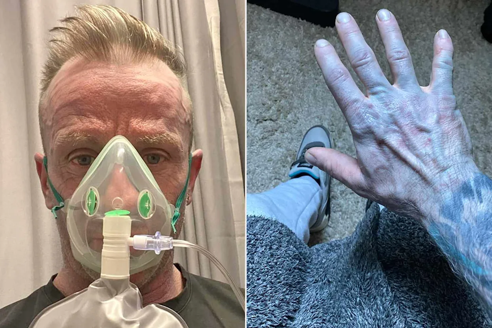 Οι γιατροί ξέσπασαν σε γέλια: Ο απίστευτος λόγος που ένας άνδρας στη Βρετανία ξύπνησε… όλος μπλε! (φώτο)