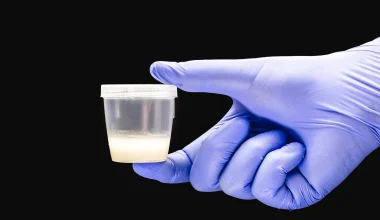 Ήταν δωρητής σπέρματος για 5 χρόνια κρυφά από τη γυναίκα του – Είχε και προφίλ στα social media!