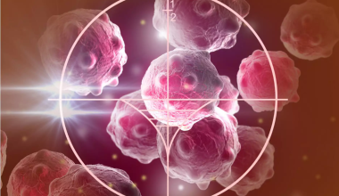 Οι άνδρες ή οι γυναίκες έχουν περισσότερες πιθανότητες να νικήσουν τον καρκίνο; – Τι αναφέρει νέα μελέτη