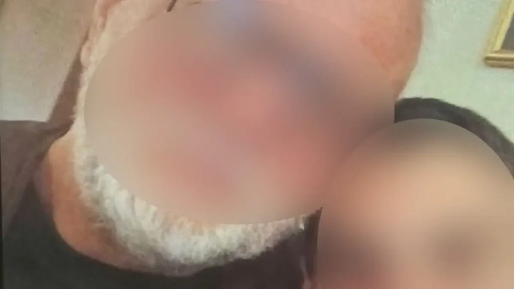 Πατέρας 24χρονης στη Βέροια: «Το παιδί βρίσκεται ακόμα σε κώμα» – «Δολοφονικά» τα χτυπήματα του 20χρονου