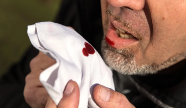 Αιμόπτυση: Τι σημαίνει η απόχρωση και υφή του αίματος – Ποιες οι αιτίες