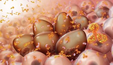 Πολλαπλό μυέλωμα: Δείτε ποια είναι τα συμπτώματα που εμφανίζονται στο πρώιμο στάδιο