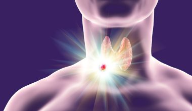 Όσα πρέπει να ξέρετε για τους όζους θυρεοειδούς: Τα συμπτώματα και οι πιθανές αιτίες