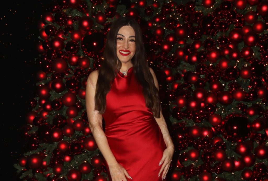 Ι.Παλιοσπύρου: «Έμαθα να αγαπώ το σώμα μου ξανά γιατί με κράτησε ζωντανή»