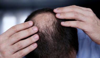 Η Κίνα «φέρνει» το τέλος της… καράφλας: Νέος φυτικός ορός επαναφέρει τα μαλλιά μέσα σε λίγες εβδομάδες!