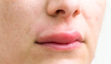 Δείτε γιατί κάποιες φορές ξυπνάτε με πρησμένα χείλη – Όλες οι πιθανές αιτίες