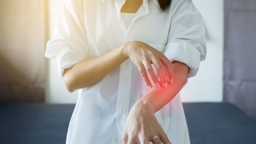 Όσα πρέπει να ξέρετε για το εξάνθημα Χασιμότο: Πώς εμφανίζεται και πώς να το αντιμετωπίσετε