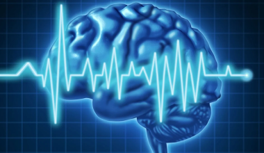 Νέα μελέτη: Το βαρύ εγκεφαλικό επεισόδιο αυξάνει τον κίνδυνο για άνοια