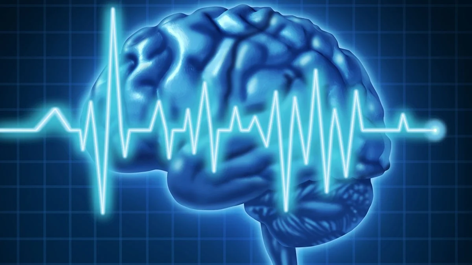 Νέα μελέτη: Το βαρύ εγκεφαλικό επεισόδιο αυξάνει τον κίνδυνο για άνοια