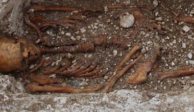 Νέα έρευνα: Με υδράργυρο επιχειρούσαν να θεραπεύσουν τη λέπρα στον Μεσαίωνα