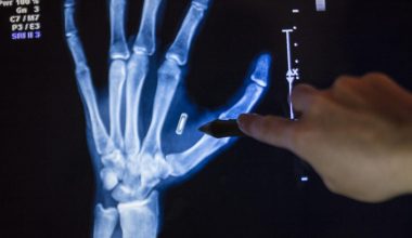 Βίντεο: Στο Μουσείο του Μέλλοντος του Ντουμπάι εκθέτουν μικροτσιπ που θα εμφυτευτούν στους ανθρώπους!