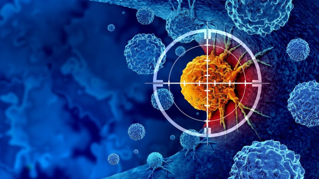FDA: Έδωσε το «πράσινο φως» σε νέα αντικαρκινική θεραπεία με ηχητικά κύματα αντί για χημειοθεραπεία