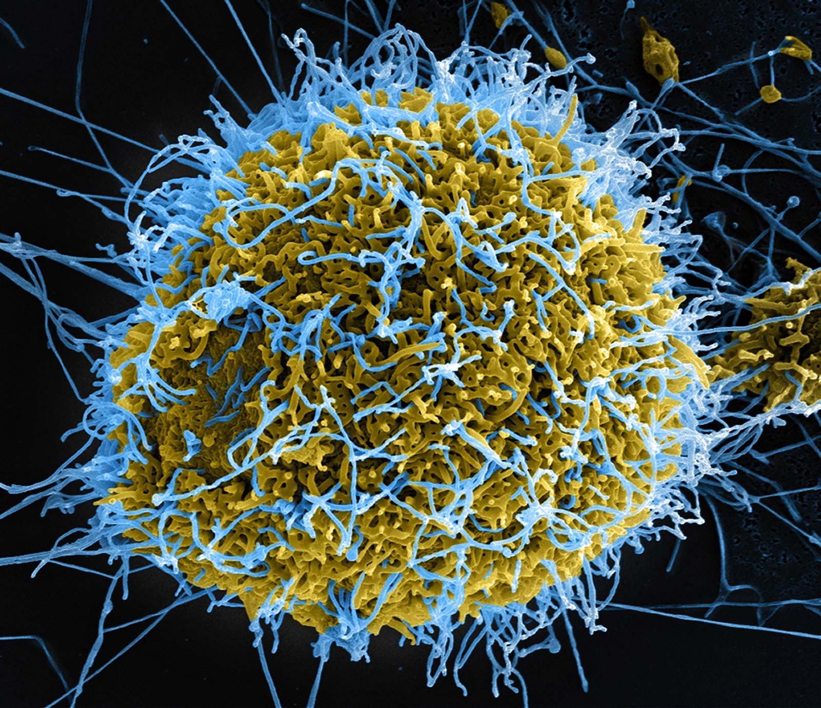 Κρούσμα του ιού Έμπολα στην Ιταλία – Σε απομόνωση ο ασθενής